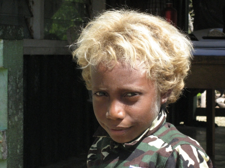 Genetics of blond hair in Solomon Islanders