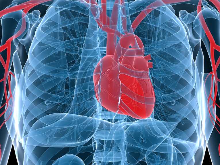 Arthritis sufferers at higher heart disease risk