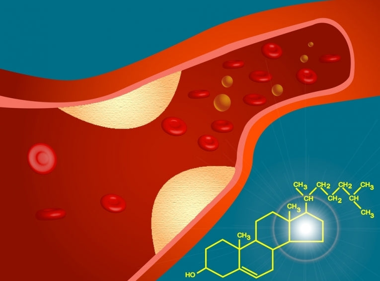 New drugs may treat hardening of the arteries