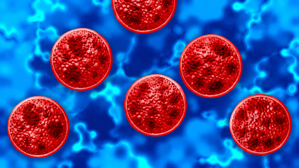 Cyclosporiasis Outbreak